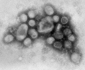 First Swine Flu Case Confirmed in Flathead County